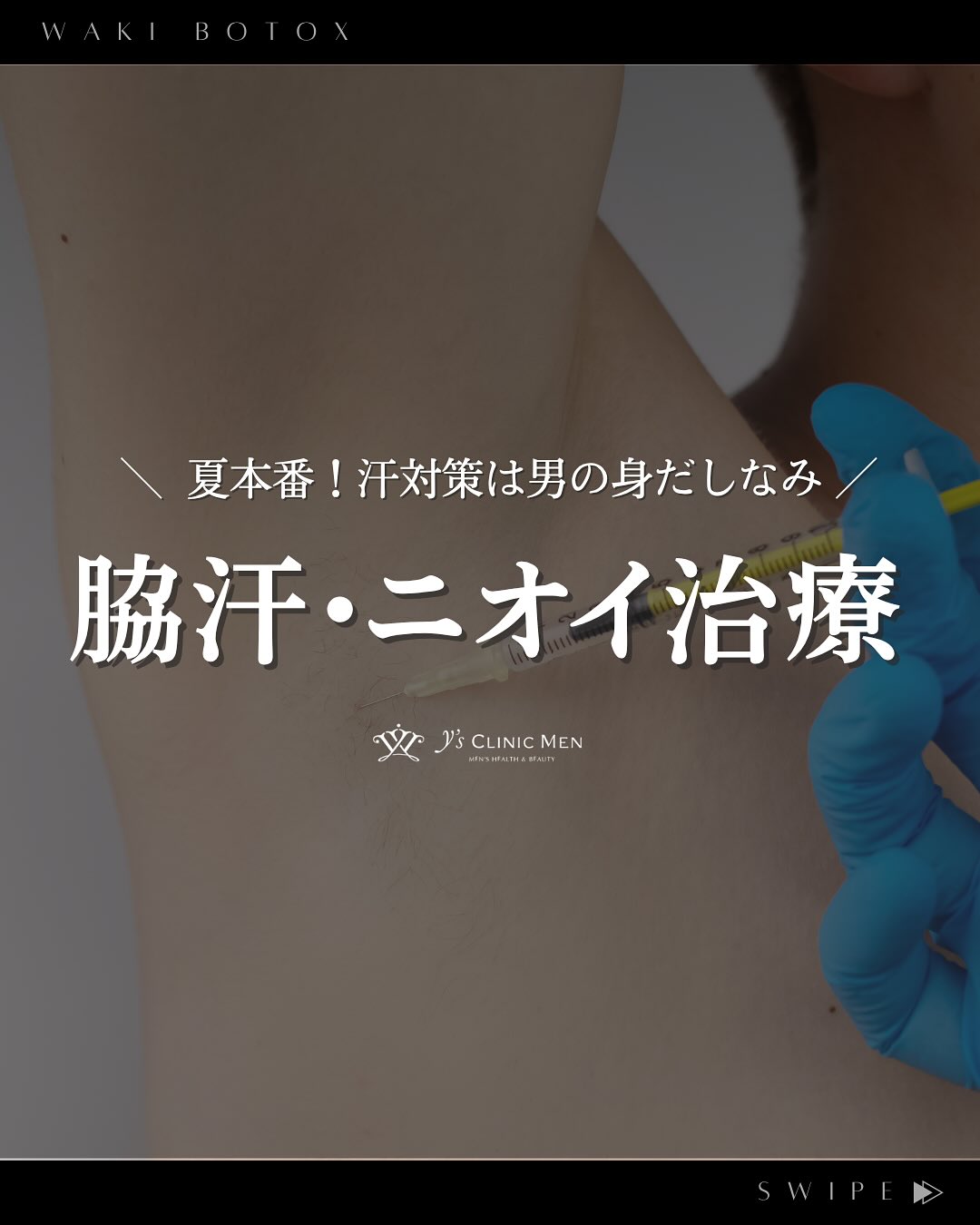 ご覧いただきありがとうございます!
大阪心斎橋の美容クリニック Y’s CLINIC MENです
🔻 follow me 🔻
@ysclinic_men
……………………………………………………
\💪 夏本番!汗・ニオイ対策は男の身だしなみ/
こんなお悩み、ありませんか?
☑ 脇汗の量が多くて気になる
☑ 脇のニオイが気になる
☑ シャツに汗ジミができる
☑ 周りに不快感を与えていないか不安
そんな方におすすめなのが 脇ボトックス 💉
汗の原因となる神経伝達を抑えて、汗・ニオイをダブルでブロック!
治療は短時間&ダウンタイムもほぼなし。自然に快適さを手に入れられます。
🩵 8月キャンペーン 🩵
アラガン社製ボトックスビスタ
77,000円 → 61,600円(税込)
韓国製ボツラックス
55,000円 → 44,000円(税込)
まずは無料カウンセリングでご相談ください!
「これって脇ボトックスで改善できる?」というお悩みもお気軽に✨
⠀
y'sクリニックMENでは、
👨⚕️ 包茎手術の実績が豊富な泌尿器科専門医が執刀
📋 プライバシーを守る完全予約制・完全個室
🙆♂️ 性感度・勃起機能を温存
⠀
#ysclinicmen #ワイズクリニックメン #美容クリニック大阪 #美容整形外科 #大阪美容 #美容クリニック #美容外科 #スキンケア #メンズスキンケア #メンズケア
#脇ボトックス #ボトックス #メンズ #アラガン社 #汗予防 #汗 #臭いケア